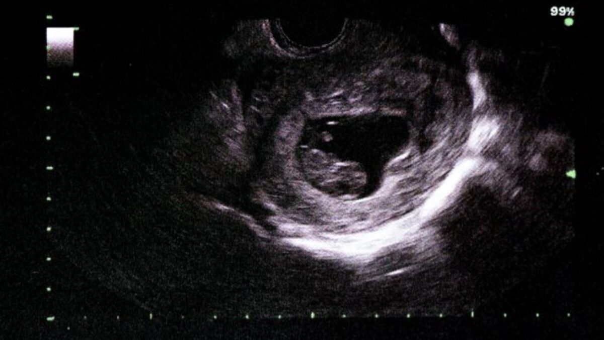 Dua Janin Ditemukan di Septic Tank Apartemen Begawan Malang, Polisi Selidiki Asal Kamar