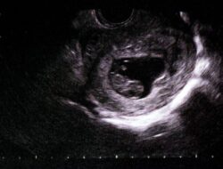 Dua Janin Ditemukan di Septic Tank Apartemen Begawan Malang, Polisi Selidiki Asal Kamar