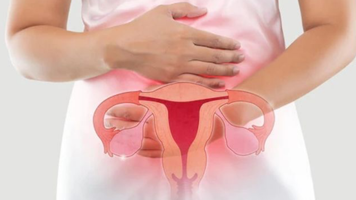 Partisipasi Tinggi, Penanganan Kanker Serviks di Malang Kini Didominasi Kasus Awal