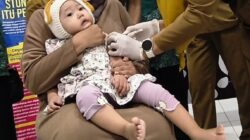 Indonesia Peringkat Kedua Kasus Campak Dunia, Alarm Serius Kesehatan Anak Indonesia Peringkat Kedua Kasus Campak Dunia, Alarm Serius Kesehatan Anak